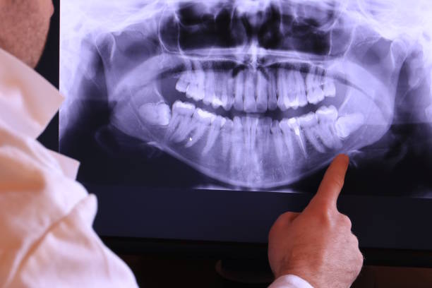 Best Emergency Root Canal Treatment in Unionville, MO