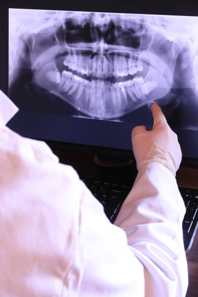 Best Emergency Dentist for Lost Fillings or Crowns in Unionville, MO