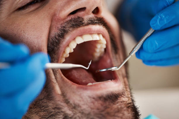 Best Urgent Dental Care for Toothache in Unionville, MO